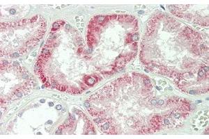 Detection of IFNb in Human Kidney Tissue using Polyclonal Antibody to Interferon Beta (IFNb) (IFNB1 Antikörper  (AA 22-187))