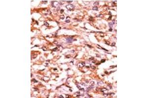 Image no. 2 for anti-Cell Division Cycle 25 Homolog B (S. Pombe) (CDC25B) (pSer187) antibody (ABIN358100)