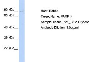 Host: Rabbit Target Name: PARP14 Sample Type: 721_B Whole Cell lysates Antibody Dilution: 1. (PARP14 Antikörper  (C-Term))