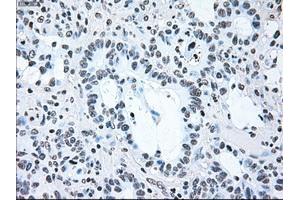 Image no. 2 for anti-B-Raf proto-oncogene, serine/threonine kinase (BRAF) antibody (ABIN1496961) (BRAF Antikörper)
