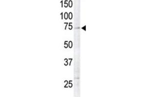 Western Blotting (WB) image for anti-Ribosomal Protein S6 Kinase, 90kDa, Polypeptide 6 (RPS6KA6) antibody (ABIN5023859) (RPS6KA6 Antikörper)