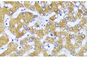 Immunohistochemistry of paraffin-embedded Human liver using ACOX2 Polyclonal Antibody at dilution of 1:100 (40x lens). (Acox2 Antikörper)