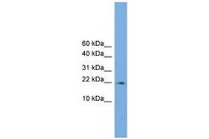 Image no. 1 for anti-Peptidylprolyl Isomerase (Cyclophilin)-Like 3 (PPIL3) (AA 35-84) antibody (ABIN6744906) (PPIL3 Antikörper  (AA 35-84))