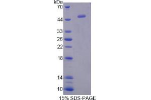 Image no. 1 for Interferon, alpha 5 (IFNA5) (AA 24-189) protein (His tag,GST tag) (ABIN6238354) (IFNA5 Protein (AA 24-189) (His tag,GST tag))