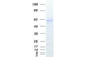 Western Blotting (WB) image for X-Linked Inhibitor of Apoptosis (XIAP) protein (Myc-DYKDDDDK Tag) (ABIN2723210)