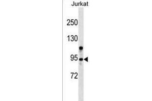 ZMYM6 Antibody (N-term) (ABIN1539123 and ABIN2849256) western blot analysis in Jurkat cell line lysates (35 μg/lane). (ZMYM6 Antikörper  (N-Term))