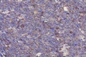 Immunohistochemistry analysis of paraffin-embedded human tonsil using,RPL10 (ABIN7075428) at dilution of 1: 4000 (RPL10 Antikörper)