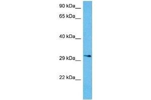 Host:  Mouse  Target Name:  KCNIP3  Sample Tissue:  Mouse Brain  Antibody Dilution:  1ug/ml (DREAM Antikörper  (N-Term))