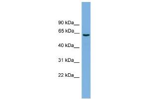 WB Suggested Anti-SLCO1A2 Antibody Titration: 0.