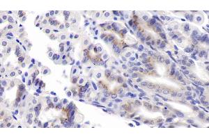 Immunohistochemistry (IHC) image for anti-serpin Peptidase Inhibitor, Clade F (Alpha-2 Antiplasmin, Pigment Epithelium Derived Factor), Member 1 (SERPINF1) (AA 19-417) antibody (ABIN7428680)