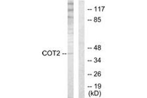 Western blot analysis of extracts from HuvEc cells, using COT2 Antibody. (Grr1p Antikörper  (AA 1-50))