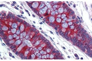 Human Colon; Immunohistochemistry with Human Colon lysate tissue at an antibody concentration of 5. (ABCA5 Antikörper  (C-Term))