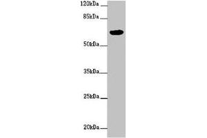 Western blot All lanes: FBXW5 antibody at 2 μg/mL + PC-3 whole cell lysate Secondary Goat polyclonal to rabbit IgG at 1/10000 dilution Predicted band size: 64, 43 kDa Observed band size: 64 kDa (FBXW5 Antikörper  (AA 265-494))