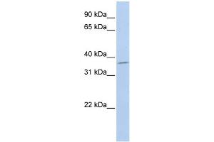 WB Suggested Anti-SLFNL1 Antibody Titration: 0. (Schlafen-Like 1 Antikörper  (Middle Region))