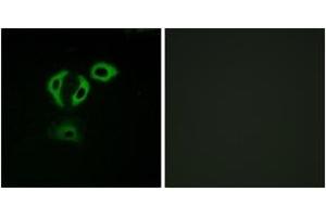 Immunofluorescence analysis of A549 cells, using TACC3 Antibody. (TACC3 Antikörper  (AA 789-838))