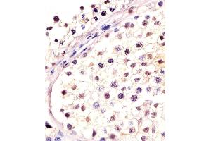 Antibody staining DPPA4 in human testis tissue sections by Immunohistochemistry (IHC-P - paraformaldehyde-fixed, paraffin-embedded sections). (DPPA4 Antikörper  (N-Term))