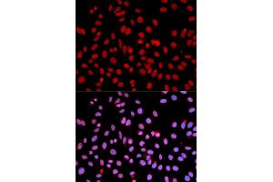 Immunofluorescence analysis of U2OS cells using POLR2J antibody (ABIN3015606, ABIN3015607, ABIN3015608 and ABIN6218969).
