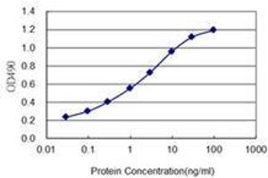 Detection limit for recombinant GST tagged PAX2 is 0. (PAX2A Antikörper  (AA 194-303))