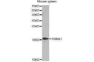 Western blot analysis of extracts of mouse spleen, using SSNA1 antibody. (SSNA1 Antikörper)