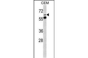 Western blot analysis of FKBP10 Antibody in CEM cell line lysates (35ug/lane) (FKBP10 Antikörper  (N-Term))