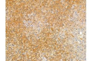 ABIN7094504 and ABIN7098553 at 1/100 staining Rat liver tissue by IHC-P. (Kallikrein 9 Antikörper  (C-Term))