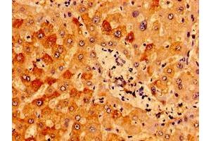 Immunohistochemistry of paraffin-embedded human liver tissue using ABIN7156987 at dilution of 1:100 (IFT46 Antikörper  (AA 1-304))