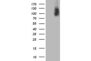 Western Blotting (WB) image for anti-Biotin-Protein Ligase (HLCS) antibody (ABIN1498678)