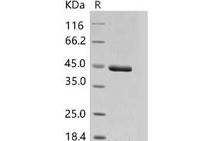 Chitinase 3-Like 1 (Cartilage Glycoprotein-39) (CHI3L1) protein (His tag)