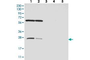 Western blot analysis of Lane 1: RT-4, Lane 2: U-251 MG, Lane 3: Human Plasma, Lane 4: Liver, Lane 5: Tonsil with MRPS15 polyclonal antibody . (MRPS15 Antikörper)