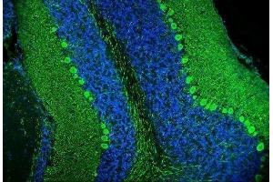 IF analysis of Calbindin using anti-Calbindin antibody (ABIN6719541). (CALB1 Antikörper  (AA 2-261))