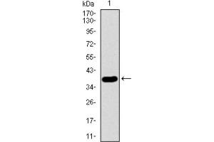 Western blot analysis using SFTPC antibody against HEK293 (1) and SFTPC (AA: 60-180) -hIgGFc transfected HEK293 (2) cell lysate. (Surfactant Protein C Antikörper  (AA 60-180))