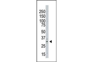 The anti-AURKC Pab (ABIN6242197 and ABIN6578977) is used in Western blot to detect AURKC in  cell lysate (Aurora Kinase C Antikörper  (C-Term))