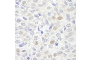 Immunohistochemistry (IHC) image for anti-General Transcription Factor 3C Polypeptide 3 (GTF3C3) (AA 475-525) antibody (ABIN7448586) (General Transcription Factor 3C Polypeptide 3 (GTF3C3) (AA 475-525) Antikörper)