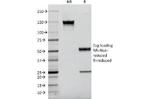 SDS-PAGE Analysis Purified CD9 Mouse Monoclonal Antibody (P1/33/2). (CD9 Antikörper)