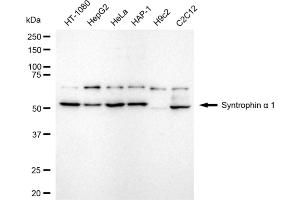 Western blotting analysis using syntrophin alpha 1 antibody (ABIN7800498).