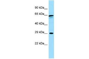 WB Suggested Anti-CALN1 Antibody Titration: 1. (Calneuron 1 Antikörper  (N-Term))