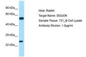 Image no. 1 for anti-Deoxyguanosine Kinase (DGUOK) (C-Term) antibody (ABIN6749986) (Deoxyguanosine Kinase Antikörper  (C-Term))