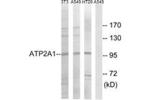 Western blot analysis of extracts from HT-29/A549/NIH-3T3 cells, using ATP2A1 Antibody. (ATP2A1/SERCA1 Antikörper  (AA 548-597))