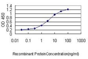 Detection limit for recombinant GST tagged SQSTM1 is approximately 0. (SQSTM1 Antikörper  (AA 1-440))