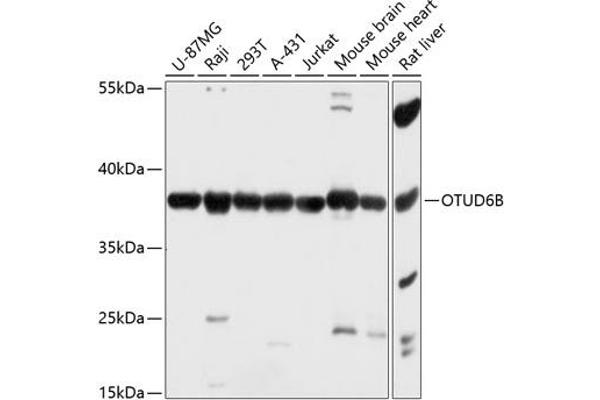 OTUD6B Antikörper  (AA 31-323)