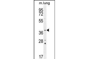 Western Blotting (WB) image for anti-Twinfilin, Actin-Binding Protein, Homolog 2 (Drosophila) (TWF2) (AA 28-57), (N-Term) antibody (ABIN655611)
