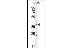PTK9L Antibody (N-term) (ABIN655611 and ABIN2845093) western blot analysis in mouse lung tissue lysates (35 μg/lane). (TWF2 Antikörper  (N-Term))