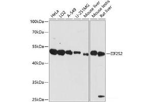 Western blot analysis of extracts of various cell lines using EIF2S2 Polyclonal Antibody at dilution of 1:3000. (EIF2S2 Antikörper)