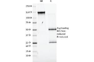 SDS-PAGE Analysis Purified CD98 Mouse Monoclonal Antibody (UM7F8). (SLC3A2 Antikörper)