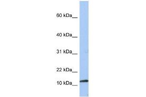 PEA15 antibody used at 1 ug/ml to detect target protein. (PEA15 Antikörper  (Middle Region))