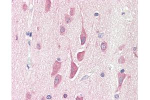 Anti-HPS6 antibody IHC staining of human brain, cortex. (HPS6 Antikörper  (AA 455-466))