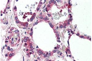Human Thyroid (formalin-fixed, paraffin-embedded) stained with MRGPRF antibody ABIN399998 at 10 ug/ml followed by biotinylated goat anti-rabbit IgG secondary antibody ABIN481713, alkaline phosphatase-streptavidin and chromogen. (Mrgprf Antikörper  (N-Term))
