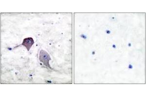 Immunohistochemistry analysis of paraffin-embedded human brain tissue, using Presenilin 1 Antibody. (Presenilin 1 Antikörper  (AA 1-50))