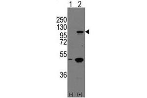 Image no. 2 for anti-P-Cadherin (CDH3) (C-Term) antibody (ABIN357039)