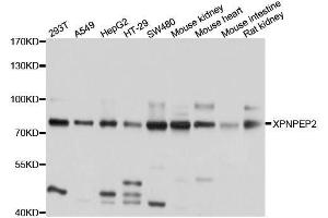 Western blot analysis of extracts of various cell lines, using XPNPEP2 antibody. (XPNPEP2 Antikörper  (AA 22-240))